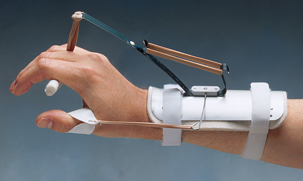 NC15673_Bunnell_Thomas_Suspension_Splint.jpg