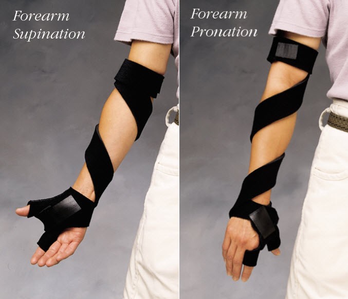 Elbow And Forearm Orthoses Arm Brace Forearm Pronation Elbow
