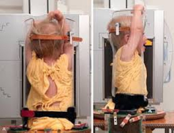 Pigg-O-Stat Complete Pediatric Immobilizer : Pediatric Diagnostic Tools