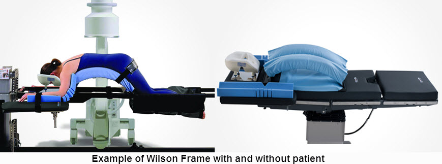 Wilson Comfort And Accessibility Kit For Wilson Surgery Table Frame