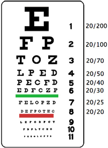 Snellen Non-Reflective Eye Exam Chart, Set of 5