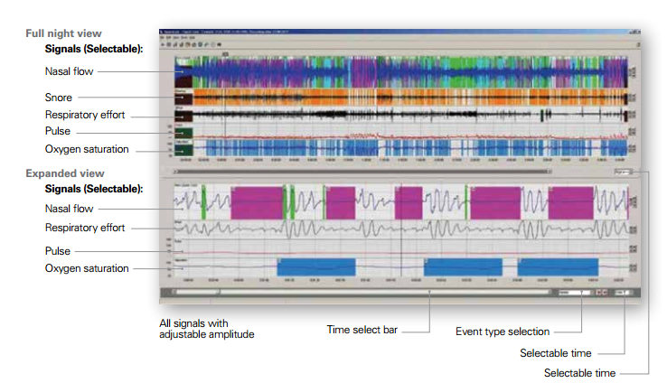 Apnealink plus software download