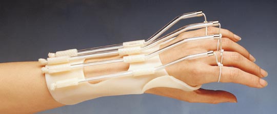 Post-Operation Finger and Wrist Orfitube Kit