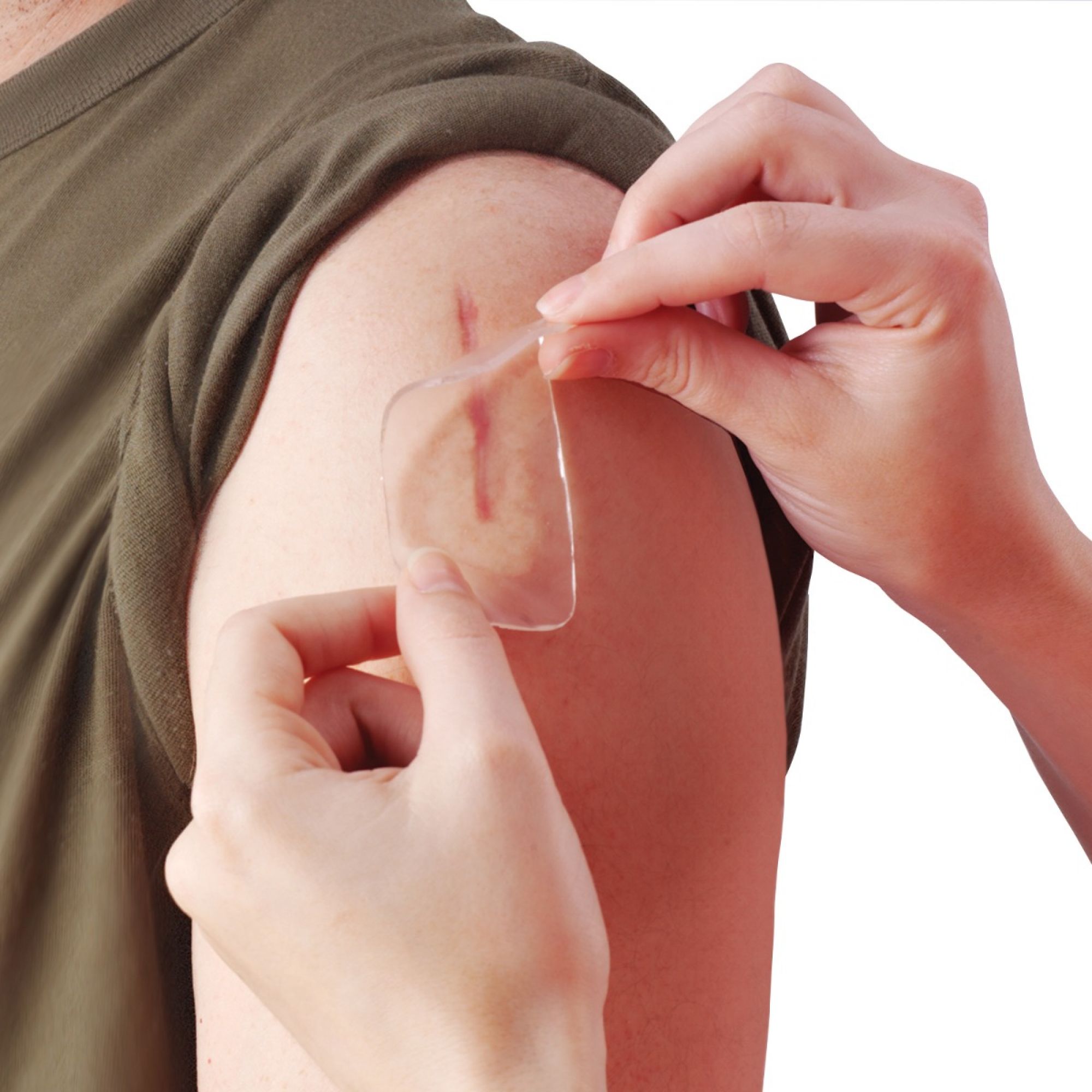 silicone scar sheets silicone scar sheets