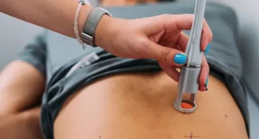 What Are the Best Cold Laser Therapy Brands for Pain Relief?