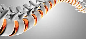 Non-Surgical Treatment Device for Scoliosis by Meditrac