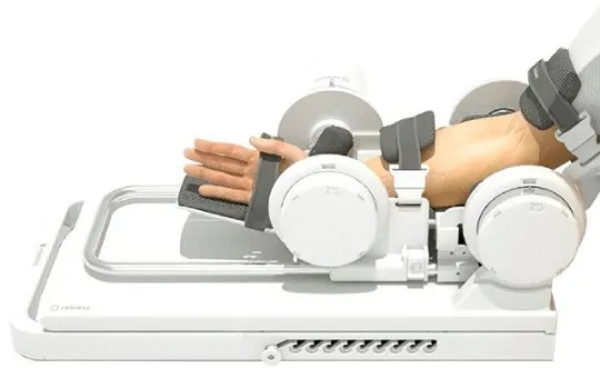 Wrist Radial Deviation
