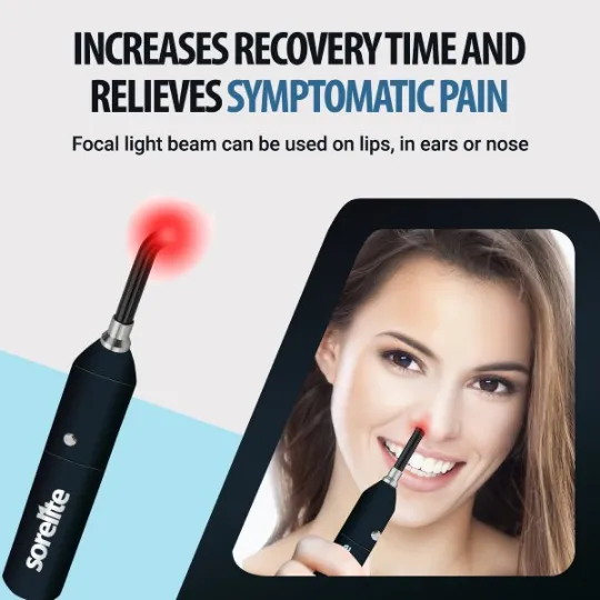Sorelite Red Light Therapy Wand for Cold Sores