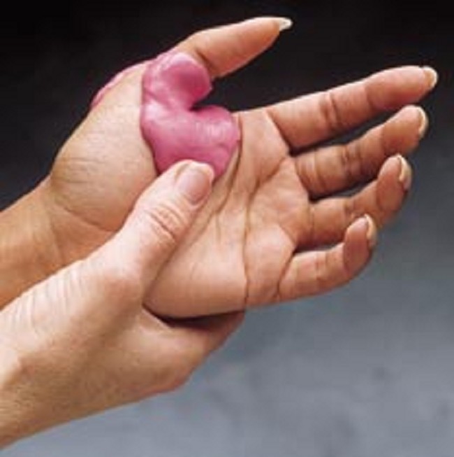 Puttylike Elastomer Kits for Scar Treatments