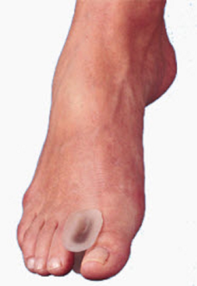 ViscoGel Toe Spacers 4 per Pack FREE Shipping