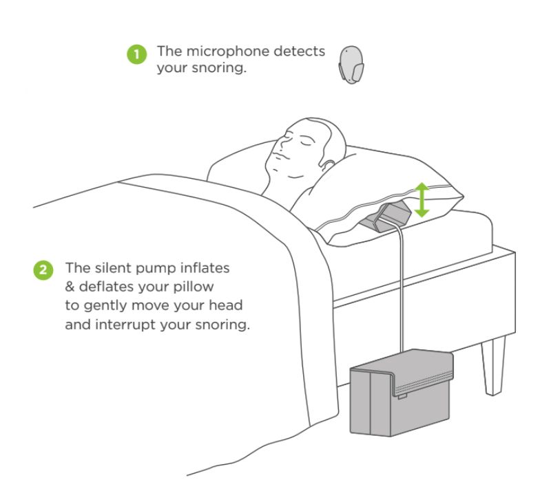 How a Leg Pillow Can Change Your Sleep - Smart Nora