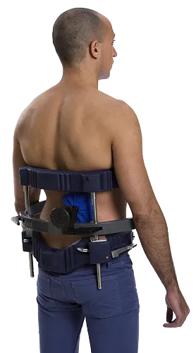 scoliosis-therapy