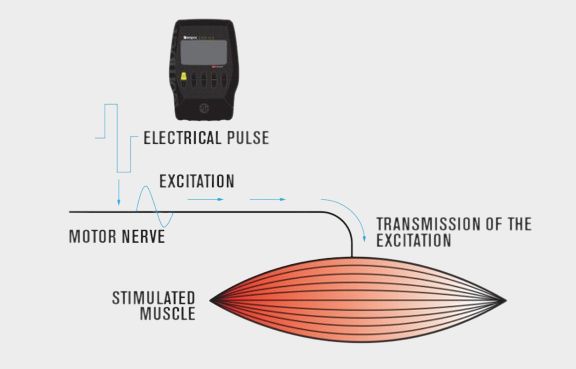 How to Choose the Right Electrical Muscle Stimulator?