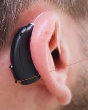elehear-in-ear-hearing-aid